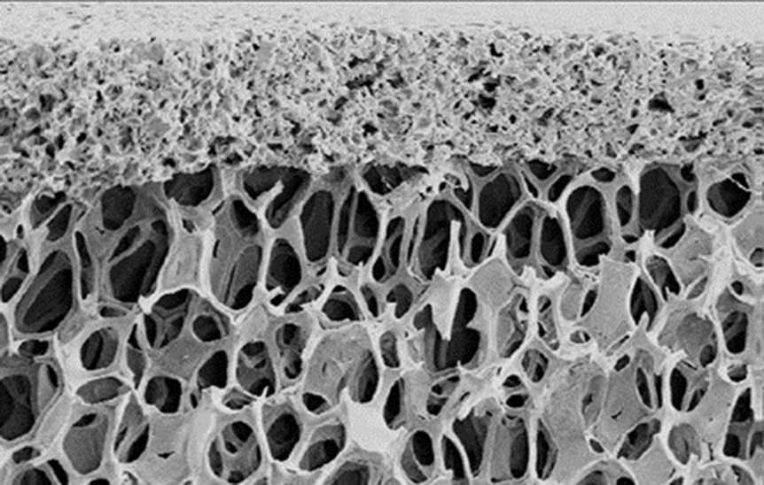 Mikroskopische Ansicht von gradierter Schaumkeramik mit dem oberen Teil zu einer Platte verdichtet und darunter in netzartiger Struktur.