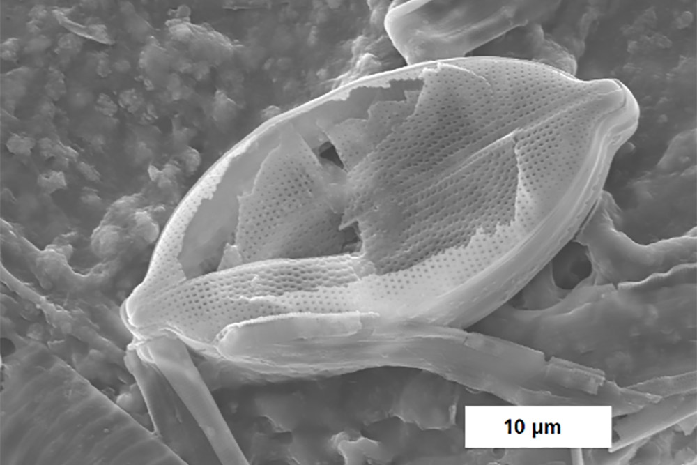 REM-Bild der Oberfläche eines gealterten Plastikpartikels mit biologischer Anhaftung.